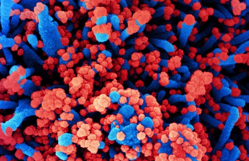Micrografía electrónica de barrido de células humanas (azul) infectadas con SARS-CoV-2 (rojo)./NIH.