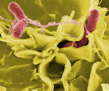 Imagen al microscopio electrónico de 'Salmonella typhimurium' infectando células humanas