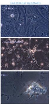 Distintas fases de un célula epitelial en apoptosis (Foto: Red IRIS)