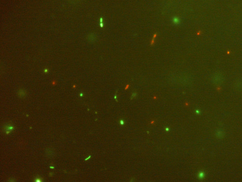Imagen microscópica de microbiota fecal aislada. En rojo se ven las bacterias vivas y en verde las muertas. / CSIC.