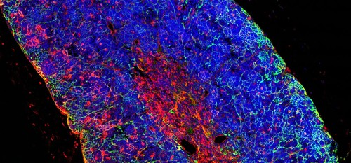 Imagen de un timo, órgano donde se inicia la transformación de las células que generan la leucemia aguda de células T. / CSIC.