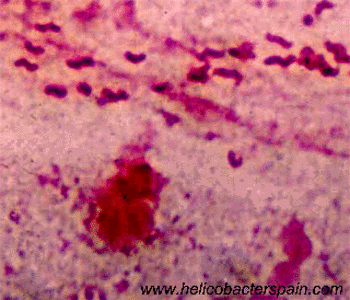 imagen ampliada de 'helicobacter pylori'