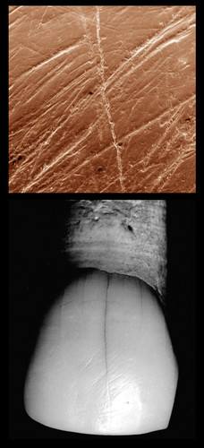 Estrías labiales en un incisivo superior del Individuo II de la Sima de los Huesos, visualizadas con microscopio electrónico de barrido (Marina Lozano y José María Bermúdez de Castro).