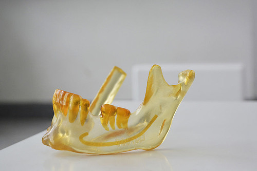 Modelos de mandíbula en impresión 3Dpara diagnóstico/Unimedios