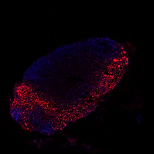 Distribución de los exosomas derivados del melanoma (rojo) en los ganglios linfáticos del ratón (azul)/CNIO