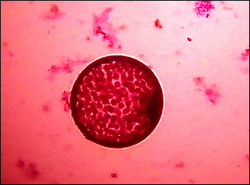 Diatomea (Coscinodiscus radiatus), aumento 10X. FOTO: UN