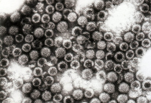 El rotavirus es un microorganismo que tiene forma de rueda (de ahí su nombre). En varias especies de vacas, cerdos y aves produce diarreas intensas, pérdida de peso, daños digestivos y gastroenteritis.