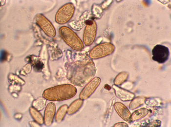 Esporas del hongo Cladosporium tal y como se ven en en el aire