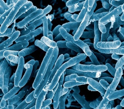 Imagen de microscopio de la bacteria Mycobacterium tuberculosis. / NIAID.
