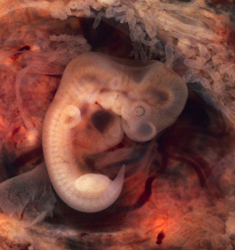 Embrión humano de cinco semanas. 