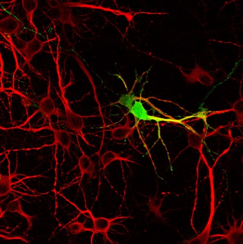Neuronas en cultivo. Imagen: Neurobiología Molecular IBSAL.
