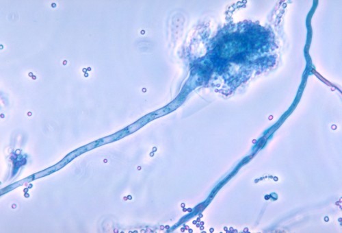Aspergillus fumigatus, un hongo común que puede conducir al agravamiento de la enfermedad pulmonar en personas con fibrosis quística.