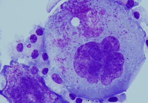Diferenciación mieloide de una célula madre de médula ósea de ratón. Imagen: USAL.