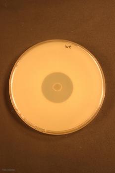 Bioensayo de pimaricina producida por 'Streptomyces natalensis' impidiendo el crecimineto del hongo 'Candida utilis'.