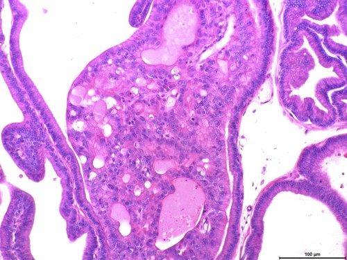 Carcinoma prostático de roedores sometidos a la restricción proteica materna. Imagen: archivo de los investigadores.