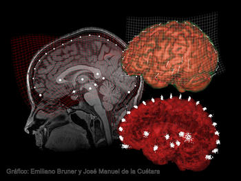 Estudio del Cenieh sobre la correlación entre la forma del cerebro y la cognición.