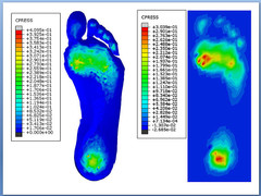 Con el modelo se evidencia cuantitativamente la interfaz de contacto entre el pie y la superficie de soporte. FOTO: UN