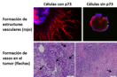 La falta del gen p73 afecta la generaciÃ³n de estructuras vasculares a partir de cÃ©lulas troncales (cÃ©lulas madre) y disminuye la capacidad de las cÃ©lulas tumorales de inducir la formaciÃ³n de vasos sanguÃ­neos que irriguen el tumor (angiogÃ©nesis)/C. 