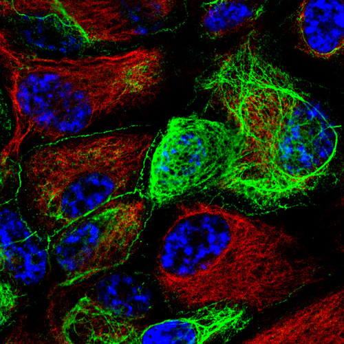 Las células epiteliales durante el proceso de polarización regulan la localización de las proteínas de polaridad (verde) y las del citoesqueleto (rojo). Azul: núcleos. Imagen: USAL.