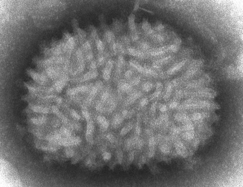 Imagen al microscopio del virus Vaccinia. / CDC / Cynthia Goldsmith.