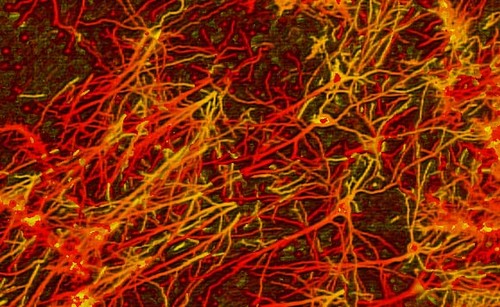Esquema de una red de neuronas.  Créditos: Willamette  University.