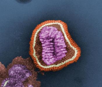 Virus de la gripe en microscopio electrónico.