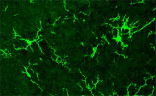 Foto de microscopía de células microgliales que responden a estímulos inflamatorios en el cerebro y liberan moléculas que pueden afectar el funcionamiento de las neuronas.