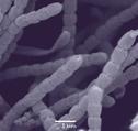 Fotografía de microscopio electrónico de Streptomyces tsukubaensis, el microorganismo productor del tacrolimus (FOTO: Inbiotec).