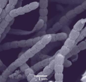 Fotografía de microscopio electrónico de 'Streptomyces tsukubaensis', el microorganismo productor del tacrolimus (FOTO: Inbiotec).