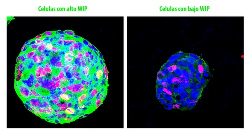 A la izquierda, células con alta proteína WIP. A la derecha, célula con baja WIP./ CBMSO