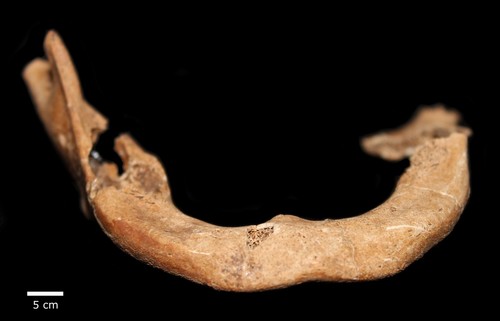 Una mandíbula del Centro de Visitantes de Panamá Viejo que carece de desarrollo dental en la parte inferior, lo que es consistente con la oligodoncia y está asociada con varios síndromes genéticos/STRI