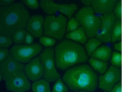 Queratinocitos, células de la piel. Fotos: CIC.