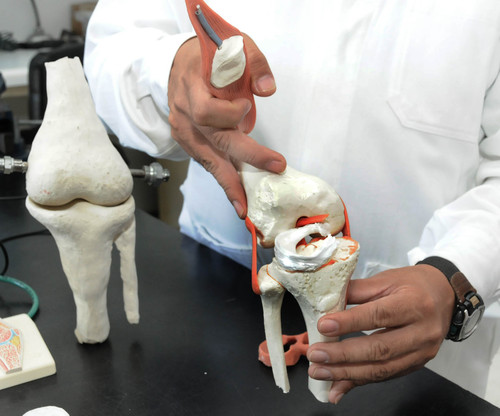 Para sustituir y/o regenerar los cartílagos de los meniscos de las rodillas, investigadores del CFATA desarrollan biofibras de polímeros para crear implantes. FOTO: UNAM.