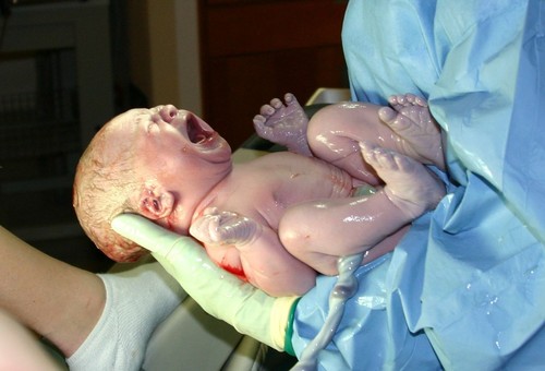 Una niña recién nacida, justo después del parto. Foto: Di Ernest F – Wikimedia.