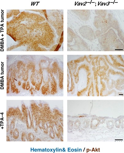 Composición de imágenes que muestra la función de las proteínas Vav en cáncer de piel. Foto: CIC.