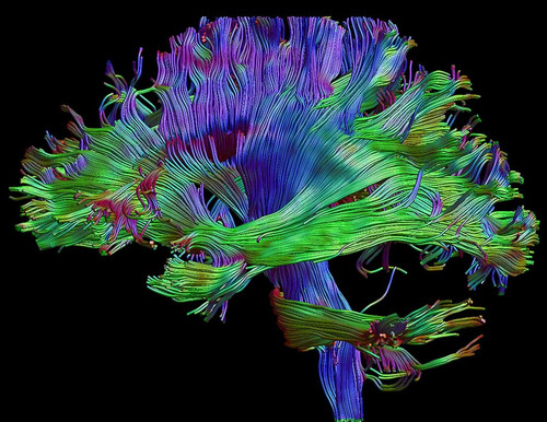 Imagen de cerebro generada a partir de resonancia magnética. Imagen: UC3M.