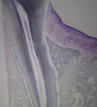 El hueso (c) crece tras la aplicación de las células frente a la base de la lesión (b). FOTO: Javier Núñez.