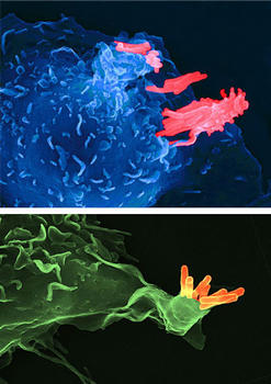 Los  macrófagos tienen sensores en su superficie para detectar a los  microorganismos patógenos. Imagen: CSIC.