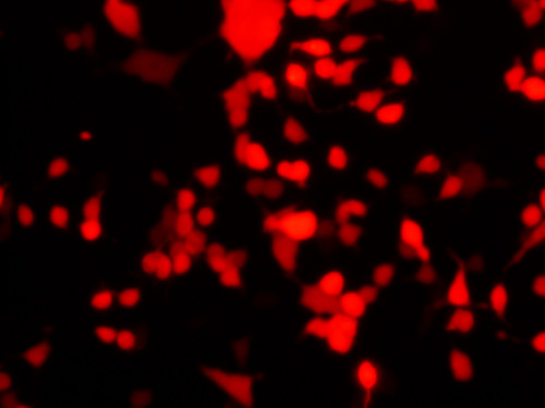 Imagen de experimentos in vitro con las células en rojo.
