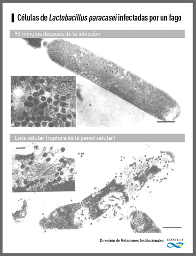 Células de Lactobacillus paracasei infectadas por un hongo. FOTO: CONICET