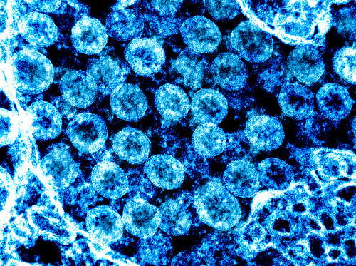 Micrografía electrónica de transmisión del virus SARS-CoV-2, aisladas de un paciente. Imagen capturada y mejorada en color en la Instalación de Investigación Integrada (IRF) del NIAID en Fort Detrick, Maryland/NIAID