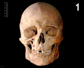 Cráneo del individo 1 hallado en La Braña-Arintero.