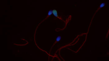 En esta imagen se observan partículas virales, de color verde, unidas a la cabeza de un espermatozoide. Foto: UDEA.