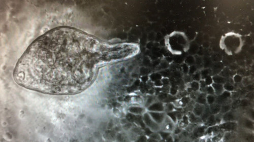 Ejemplar juvenil de Fasciola hepatica. / Imagen: Laboratorio ATENEA - IRNASA-CSIC.