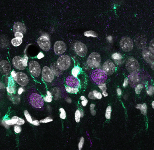Acumulación desigual de microglía (turquesa) alrededor de las neuronas superficiales de CA1 (en violeta), rodeados por otros núcleos celulares (blanco)./Elena Cid, Instituto Cajal (CSIC).