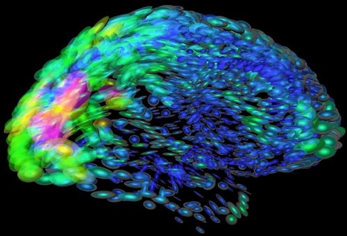 Imagen del cerebro que muestra en distintos colores las regiones con diferentes funciones. / Arthur Toga-University of California (NIH Library).