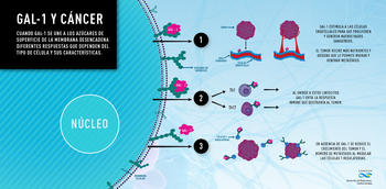 Relación entre Gal-1 y cáncer (Infografía: Conicet).