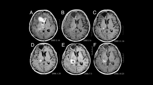 fMRI brain images./FAPESP.