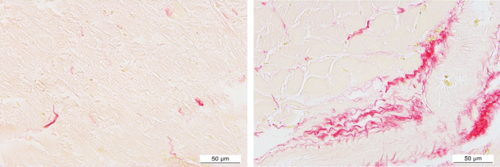 Microfotografía representativa de secciones de corazón de ratas controles y ratas obesas, con tinción de rojo sirio que marca el contenido de colágeno/Gutiérrez-Tenorio et al. 2017