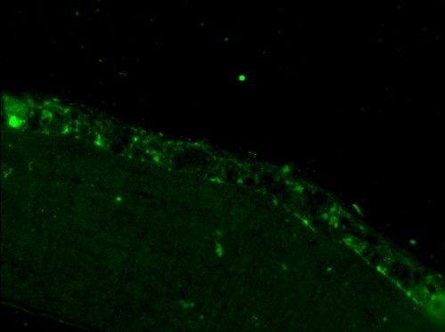Imagen de microscopía. Se observa la penetración de la proteína (en verde) en la superficie ocular/UVa
